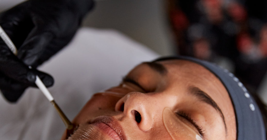 Everything You Need To Know About Chemical Peels